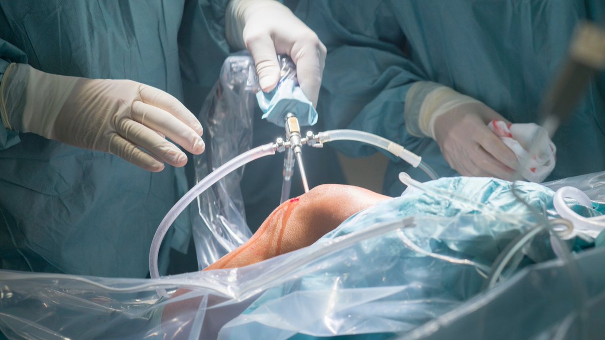 1) A short thread 🧵 on physical therapy vs. arthroscopic partial meniscectomy for traumatic meniscal tears in a young study population. 

It is based on an excellent Research Review by Dr. Travis Pollen (<a href="/trpollen/">Travis Pollen</a>).