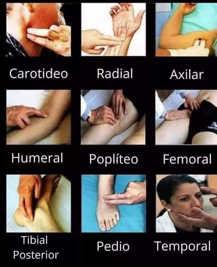 RincnCuriosoo's tweet photo. Pulsos arteriales https://t.co/8w7uxJOZii