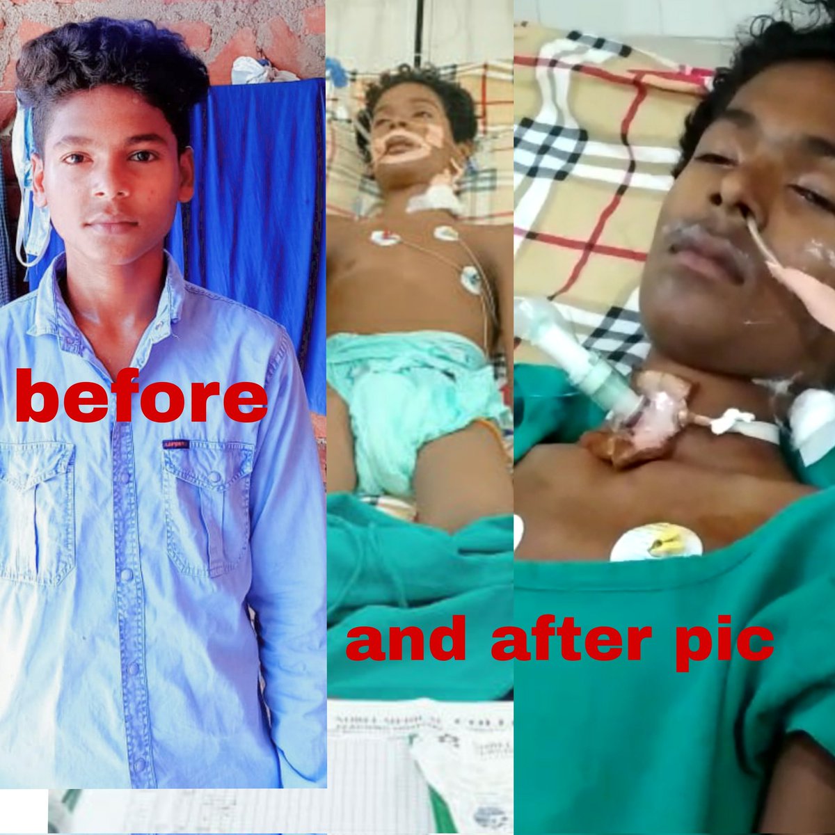 Aliyawar11072's tweet photo. @yadavtejashwi Help sir please ek bcche ki zindagi bcha ljye uska ilaj nhi ho Raha bccha bht serious condition me hai ππ hm bht dino se ap log se madad mang rahe sir please help #saveadil https://t.co/DdK1ATnDmG