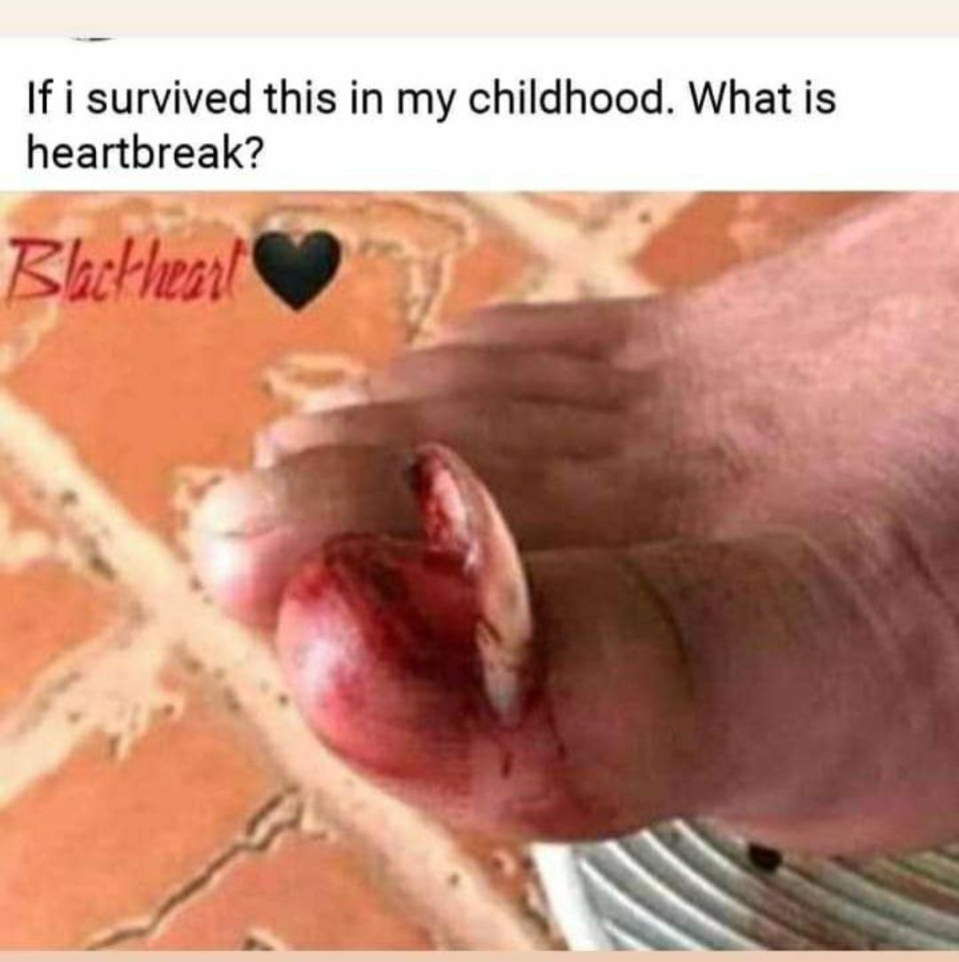 b_billbright's tweet photo. Worse heartbreak 💔 ever https://t.co/To2UbX6zPt
