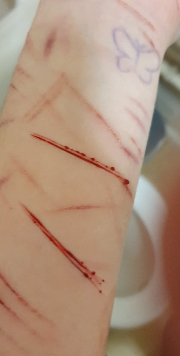 proshtwt's tweet photo. SPX MAKEUP DONT TAKE DOWN PLEASE!!!FAKEE

Relapsed during school and I'm tired now. Luckily alive cleaned it up to my best abilities https://t.co/wqF0IuBRxI