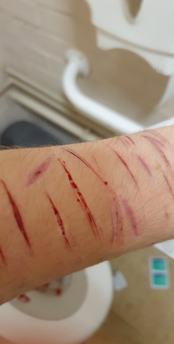 proshtwt's tweet photo. SPX MAKEUP DONT TAKE DOWN PLEASE!!!FAKEE

Relapsed during school and I'm tired now. Luckily alive cleaned it up to my best abilities https://t.co/wqF0IuBRxI