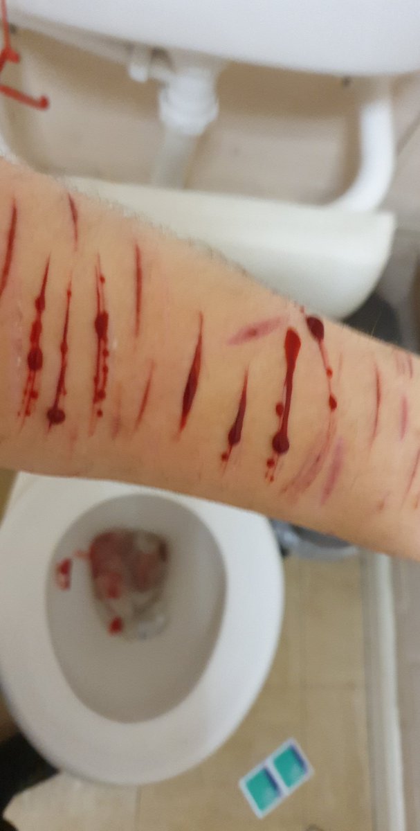 proshtwt's tweet photo. SPX MAKEUP DONT TAKE DOWN PLEASE!!!FAKEE

Relapsed during school and I'm tired now. Luckily alive cleaned it up to my best abilities https://t.co/wqF0IuBRxI