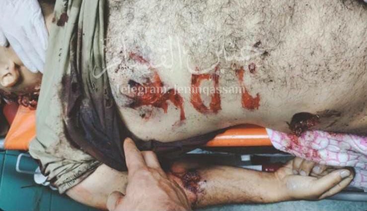 جيش احتلال مجرم يكتب على جسد الشهيد عبد الرحمن حازم بالعبرية " النهاية"