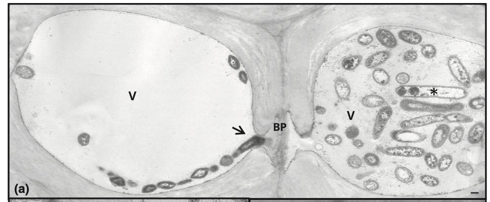 Plant Pathology tweet media