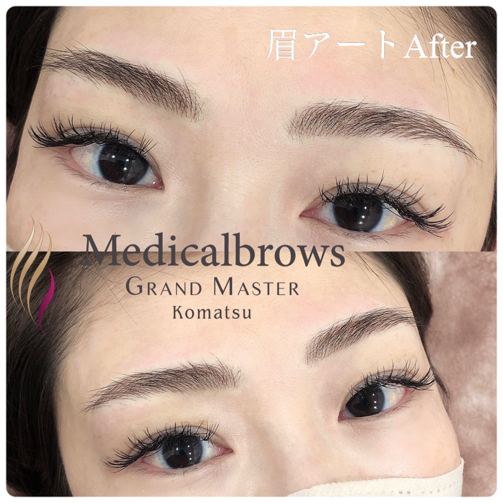 メディカルブロー小松 Komatsu Artmake Twitter