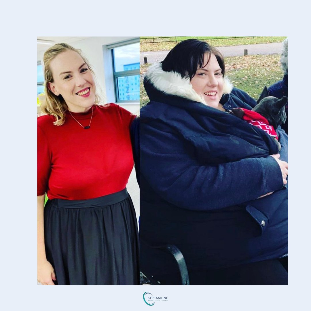 streamlinesurg's tweet photo. How amazing does @masieminibypass look, 15 stone down, 14 month post op!!🤍 https://t.co/jVL4k0Xd7S