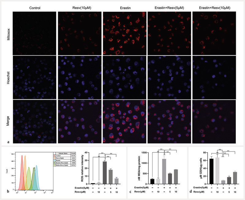 plamed_journal's tweet photo. #Ferroptosis is a newly discovered type of #celldeath that is different from other types of cell death #morphologically and #biologically.

https://t.co/q9hhzHFvR8

#plantamedica #biochemistry #Thieme #biomedicine https://t.co/XHONf68Z6Y