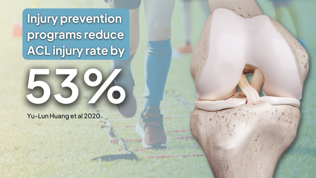 PhysioNetwork's tweet photo. 💥 ACL injury rate reduced by 53%

✅ Prevention programs work!

🔎 This study re-reviewed the evidence including only high quality RCT's due to methodological limitations of previous meta-analyses

👇🏻 See what they found here

📲 https://t.co/u6a6DGdeJU https://t.co/UFrP6nWXGd