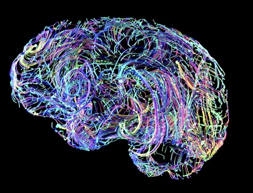 LEAD_Coalition's tweet image. The brain undergoes a great “rewiring” after age 40
bigthink.com/neuropsych/gre… via @enilev
#Alzheimers #dementia #science