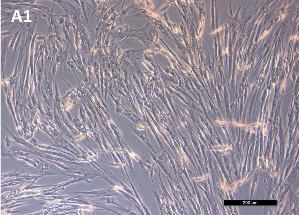 L’équipe de recherche a réussi à isoler des cellules souches du canal anal chez l’animal, ouvrant la possibilité de récolter des cellules souches à partir d’hémorroïdes chez l’humain, pour le traitement de l’incontinence anale.

🗞link.springer.com/article/10.100…