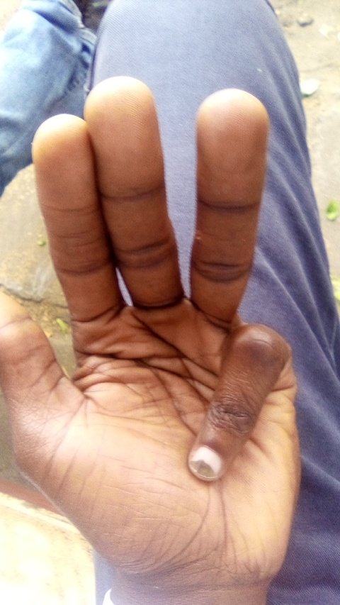 Chali_wa_Mary's tweet photo. Maybe I'll start healing Ile siku  mark itaisha ..😔😔..lakini @IEBCKenya mlituumiza uchungu.. https://t.co/p8lsyXgeee