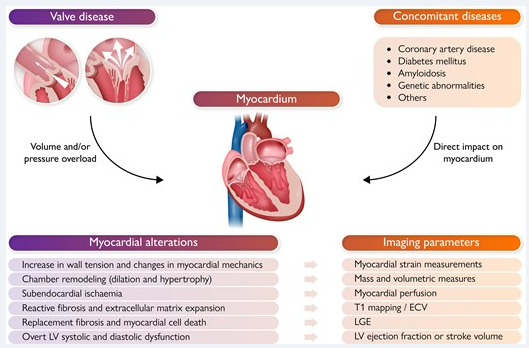 Victoria Delgado (@vdelgadogarcia) on Twitter photo Valvular heart disease: shifting the focus to the myocardium pubmed.ncbi.nlm.nih.gov/36167923/ <a href="/NAjmoneMarsan/">Nina Ajmone Marsan</a> <a href="/JoaoLCavalcante/">João Cavalcante</a> <a href="/pattypellikka/">Dr.Patricia Pellikka</a> <a href="/ehj_ed/">EHJ Editor-in-Chief</a> <a href="/SRValveCenter/">San Raffaele Heart Valve Center</a> <a href="/ValveDisease/">Structural Heart Vienna</a> <a href="/crfheart/">Cardiovascular Research Foundation</a> <a href="/PhilGenereuxMD/">Philippe Genereux</a> <a href="/ffortuni/">federico</a> <a href="/hgermanstrias/">Hosp. Germans Trias</a> Valvular heart disease: shifting the focus to the myocardium pubmed.ncbi.nlm.nih.gov/36167923/ <a href="/NAjmoneMarsan/">Nina Ajmone Marsan</a> <a href="/JoaoLCavalcante/">João Cavalcante</a> <a href="/pattypellikka/">Dr.Patricia Pellikka</a> <a href="/ehj_ed/">EHJ Editor-in-Chief</a> <a href="/SRValveCenter/">San Raffaele Heart Valve Center</a> <a href="/ValveDisease/">Structural Heart Vienna</a> <a href="/crfheart/">Cardiovascular Research Foundation</a> <a href="/PhilGenereuxMD/">Philippe Genereux</a> <a href="/ffortuni/">federico</a> <a href="/hgermanstrias/">Hosp. Germans Trias</a>