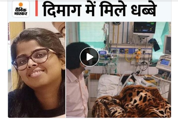 Indian DoctorЁЯЗоЁЯЗ│ (@indian__doctor) on Twitter photo рдХрд╛рдирдкреБрд░ рдореЗрдВ MBBS рдЫрд╛рддреНрд░рд╛ рдХрд╛ рдкреВрд░рд╛ рджрд┐рдорд╛рдЧ рдбреИрдореЗрдЬ:рдмреБрдЦрд╛рд░ рдЖрдиреЗ рдХреЗ 24 рдШрдВрдЯреЗ рдореЗрдВ рд╣реА рд╡реЗрдВрдЯрд┐рд▓реЗрдЯрд░ рддрдХ рдкрд╣реБрдВрдЪреА,
рдХрд╛рдирдкреБрд░ рдХреЗ GSVM рдореЗрдбрд┐рдХрд▓ рдХреЙрд▓реЗрдЬ рдореЗрдВ 16 рд╕реВрдЕрд░ рдореГрдд рдорд┐рд▓рдиреЗ рдХреЗ рдмрд╛рдж рдХреИрдВрдкрд╕ рдореЗрдВ 70 рд╕реЗ рдЬреНрдпрд╛рджрд╛ рдореЗрдбрд┐рдХрд▓ рд╕реНрдЯреВрдбреЗрдВрдЯреНрд╕ рдмреБрдЦрд╛рд░ рд╕реЗ рдкреАрдбрд╝рд┐рдд рд╣реЛ рдЧрдП рд╣реИрдВред рдПрдХ рдЫрд╛рддреНрд░рд╛ рдХреА рд╣рд╛рд▓рдд рдЧрдВрднреАрд░ рд╣реЛ рдЧрдИ рд╣реИред
<a href="/PMOIndia/">PMO India</a>
#MedTwitter рдХрд╛рдирдкреБрд░ рдореЗрдВ MBBS рдЫрд╛рддреНрд░рд╛ рдХрд╛ рдкреВрд░рд╛ рджрд┐рдорд╛рдЧ рдбреИрдореЗрдЬ:рдмреБрдЦрд╛рд░ рдЖрдиреЗ рдХреЗ 24 рдШрдВрдЯреЗ рдореЗрдВ рд╣реА рд╡реЗрдВрдЯрд┐рд▓реЗрдЯрд░ рддрдХ рдкрд╣реБрдВрдЪреА,
рдХрд╛рдирдкреБрд░ рдХреЗ GSVM рдореЗрдбрд┐рдХрд▓ рдХреЙрд▓реЗрдЬ рдореЗрдВ 16 рд╕реВрдЕрд░ рдореГрдд рдорд┐рд▓рдиреЗ рдХреЗ рдмрд╛рдж рдХреИрдВрдкрд╕ рдореЗрдВ 70 рд╕реЗ рдЬреНрдпрд╛рджрд╛ рдореЗрдбрд┐рдХрд▓ рд╕реНрдЯреВрдбреЗрдВрдЯреНрд╕ рдмреБрдЦрд╛рд░ рд╕реЗ рдкреАрдбрд╝рд┐рдд рд╣реЛ рдЧрдП рд╣реИрдВред рдПрдХ рдЫрд╛рддреНрд░рд╛ рдХреА рд╣рд╛рд▓рдд рдЧрдВрднреАрд░ рд╣реЛ рдЧрдИ рд╣реИред
<a href="/PMOIndia/">PMO India</a>
#MedTwitter