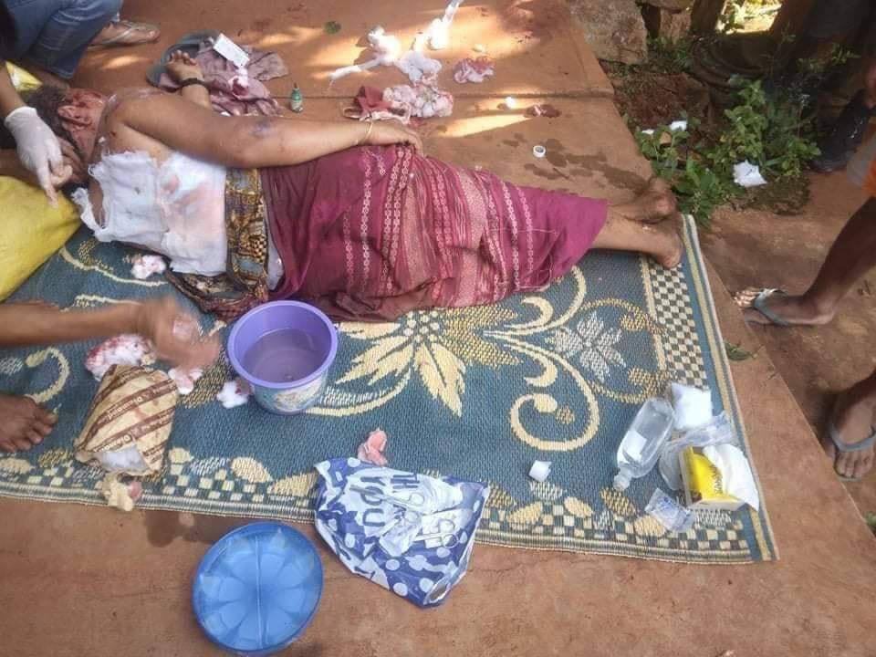 katycho22222's tweet photo. Yesterday in Kone Thar village, #Loikaw Tsp, Karenni State, a 55-year-old woman was killed. Two others were injured by indiscriminate artillery shells fired by Battalions 250 &amp; 442 of Myanmar SAC Terrorists. #2022Sept28Coup #WhatsHappeningInMyanmar https://t.co/dsDnDtJe8i