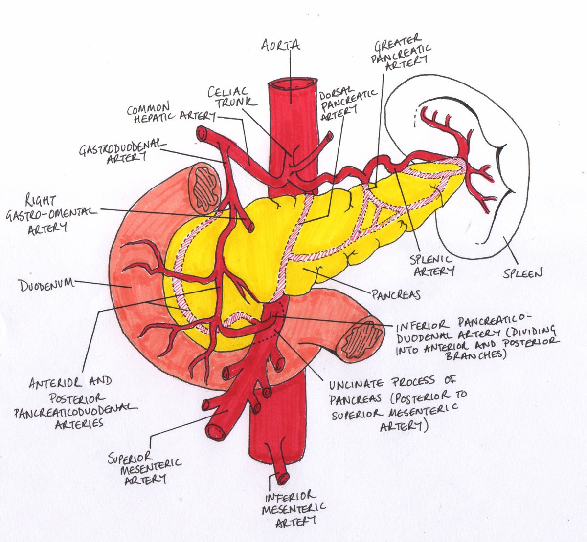 The pancreas has an abundant blood supply. In patients with pancreatitis and upper GI bleeding, always consider bleeding pseudoaneurysm 🩸💡 #4KMedEd #GITwitter

(Via <a href="/mattyheron/">Matthew Heron</a>)
matthewheron.wordpress.com/2012/04/21/17-…