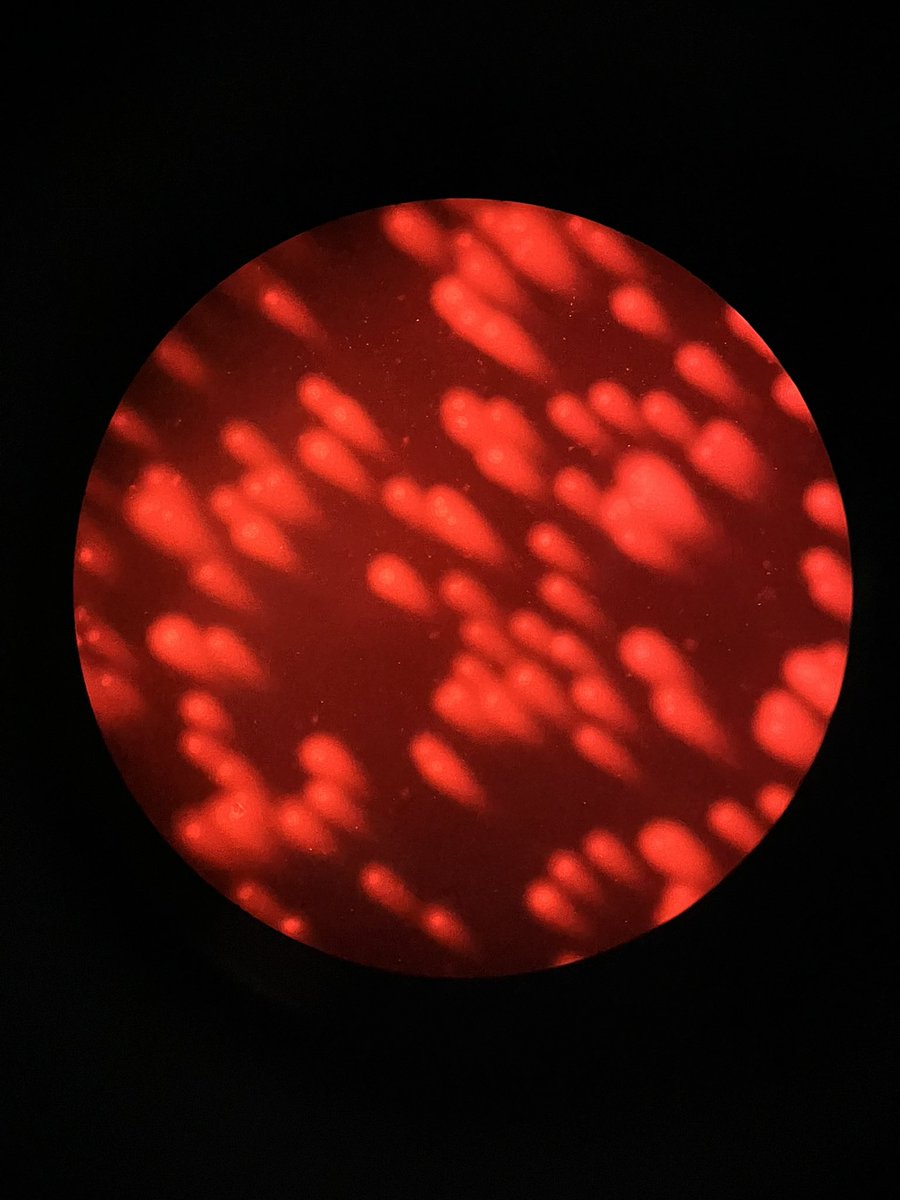 SnigdhaSarthak's tweet photo. Sometimes even the wrong buffers don’t make you suffer. 

#CancerResearch #cometassay #flourescencemicroscopy #gooddayatlab #labdiaries #cancerlab https://t.co/l5FzBIMeyt