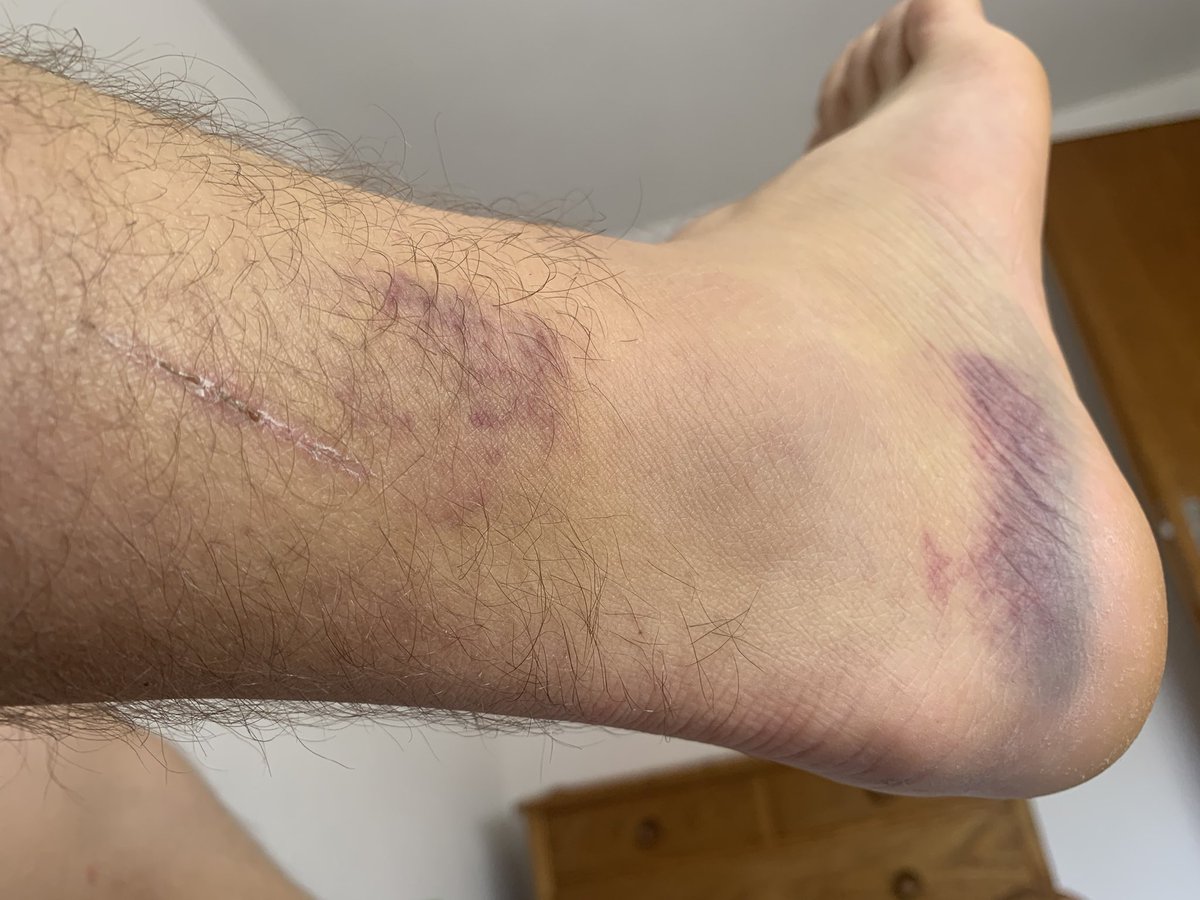 FourEels tweet media