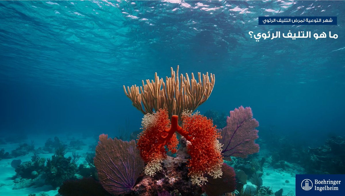 في #شهر_التوعية_بالتليف_الرئوي، نود مشاركتكم معلومات شاملة حول المرض الرئوي النادر الذي ينشأ عن ظهور ندبات في أنسجة الرئة، غرار عملية ابيضاض الشعاب المرجانية، يمكن أن يحدث المرض بشكل مفاجئ أو تدريجي.

#شهر_التليف_الرئوي