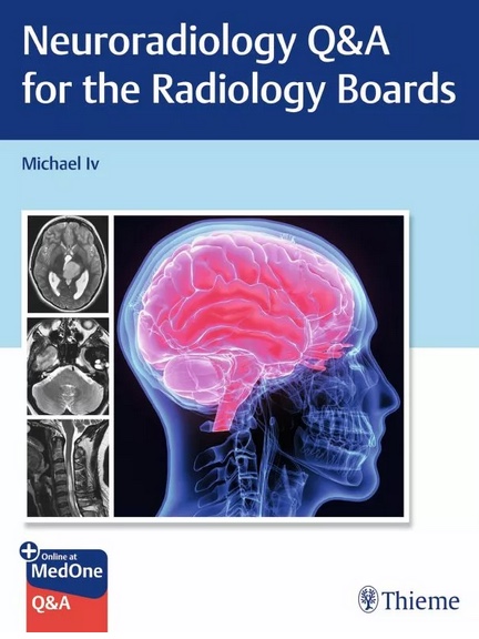 Super proud of our team for finally publishing this Neurorads Q&A book! Took years & blood, sweat, and tears! Thank you for your contributions @EricTranvinhMD @BryanLanzman @mpenta21 SyedHashmi @stanfordneuroi1 @StanfordRad @ThiemeNY tinyurl.com/muj6fpan