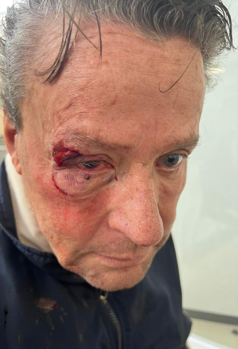 AztecaNoticias's tweet photo. Otra de #Adame. 

Alfredo Adame es golpeado al intentar tomar fotos en el incidente de #Tepepan, donde mataron a un policía. https://t.co/OQaBwBaNUF