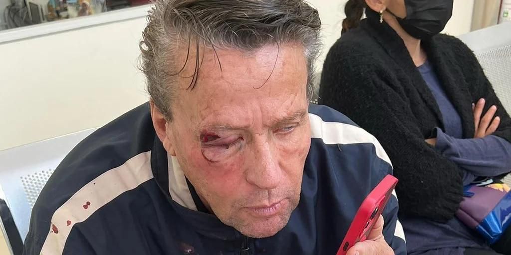 AztecaNoticias's tweet photo. Otra de #Adame. 

Alfredo Adame es golpeado al intentar tomar fotos en el incidente de #Tepepan, donde mataron a un policía. https://t.co/OQaBwBaNUF