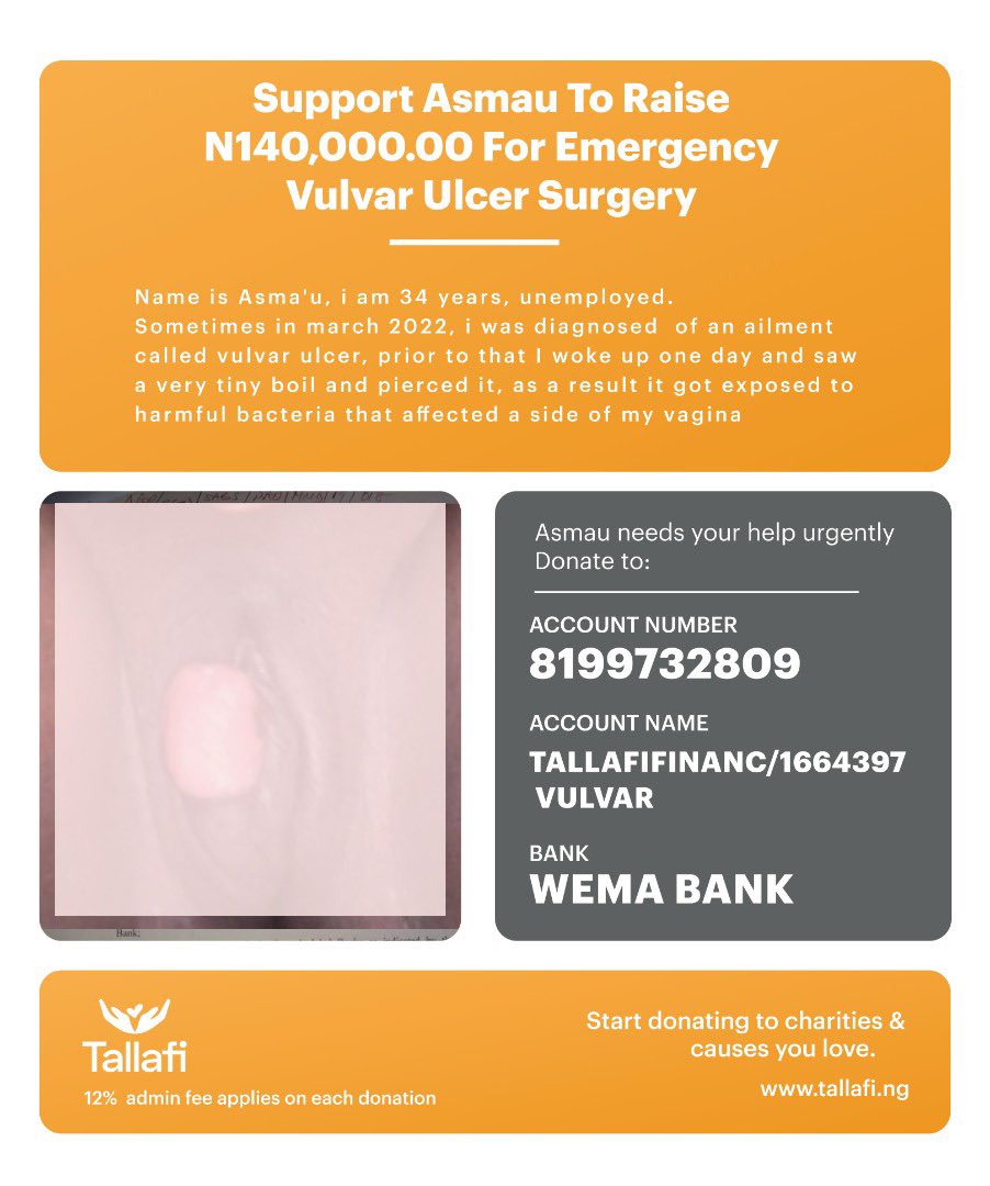 Tallafi_ng's tweet photo. Support Asmau who has an emergency surgery on 30th of September.

Send your donations to  
Wema Bank
 Account # : 8199732809 
Account Name: TallafiFinanc/1664397 

Thank you and Good bless you.
#tallafi #tallafifundme #gofundme https://t.co/cPNx9oE2wu
