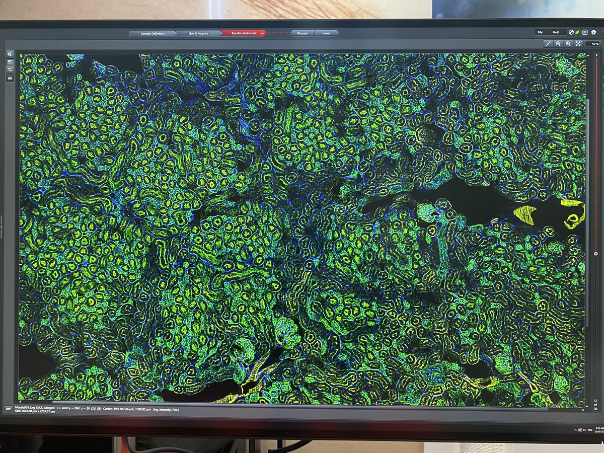 #MicaArt from ⁦@LeicaMicro⁩ 

Mica doing a fine impression of #VanGogh in it’s own special way. 

Come and see us at the Leica booth 16 ⁦@ComBio2022⁩ to find out more