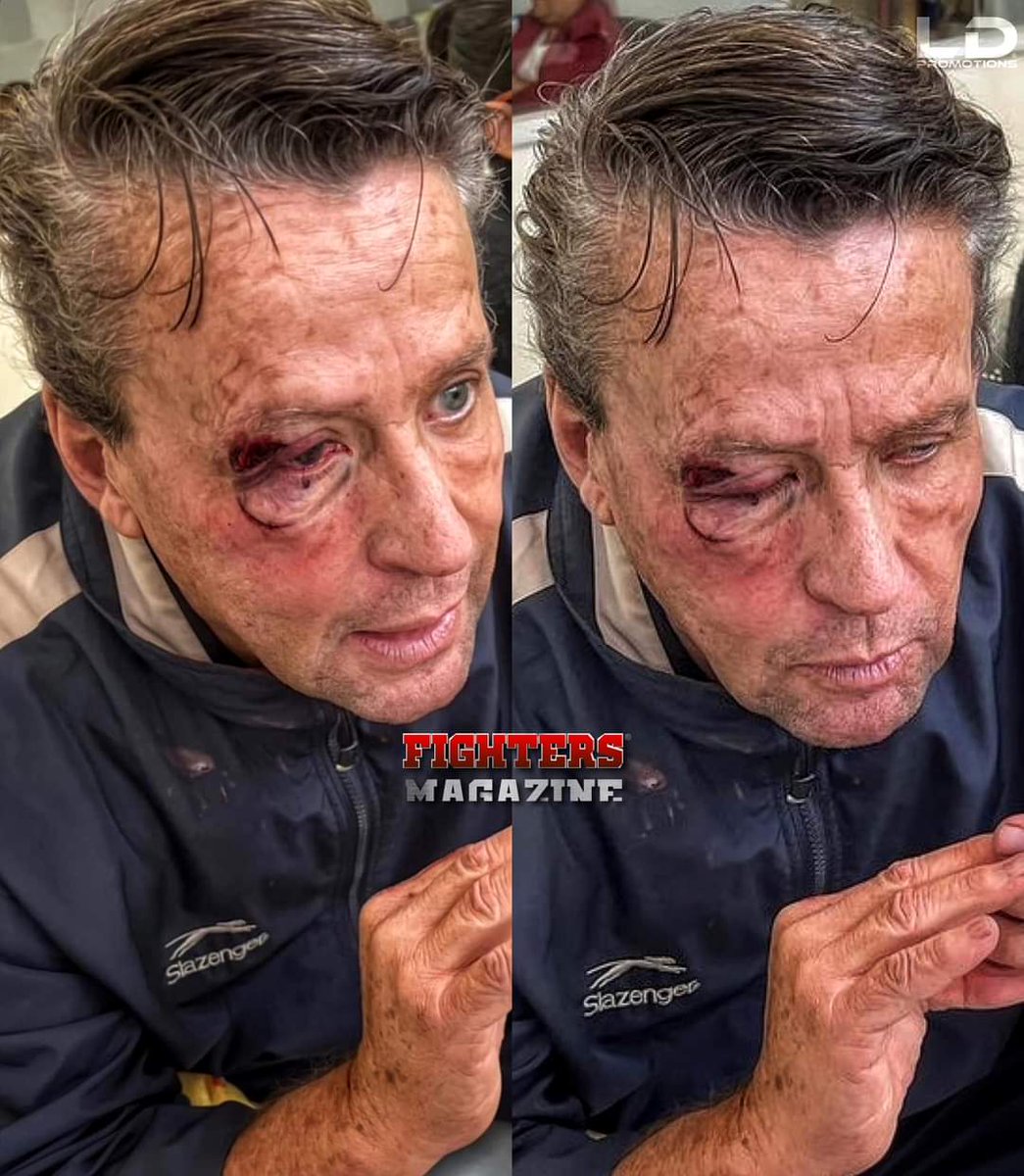 tonyriveramx's tweet photo. 🔴 #BreakingNews 🔴 🥋

"Golpean a #AlfredoAdame (de nuevo) y matan a un #Policia en la riña

#CDMX | Se registró una discusión afuera de la casa de Alfredo Adame, primeras versiones refieren que  este personaje salió a defender a una mujer..." 🧐 https://t.co/CQuK6ALIEg