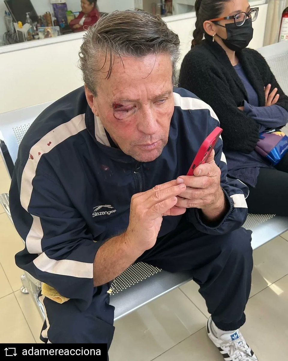 LaRedCaracol's tweet photo. #LaRed / El actor #AlfredoAdames fue fuertemente golpeado.

En incidente se presentó cerca a su casa, cuando un par de facinerosos lo atacaron para robarlo. El mexicano sufrió desprendimiento de retina y se encuentra bajo observación médica. https://t.co/e2DWhB40Ki
