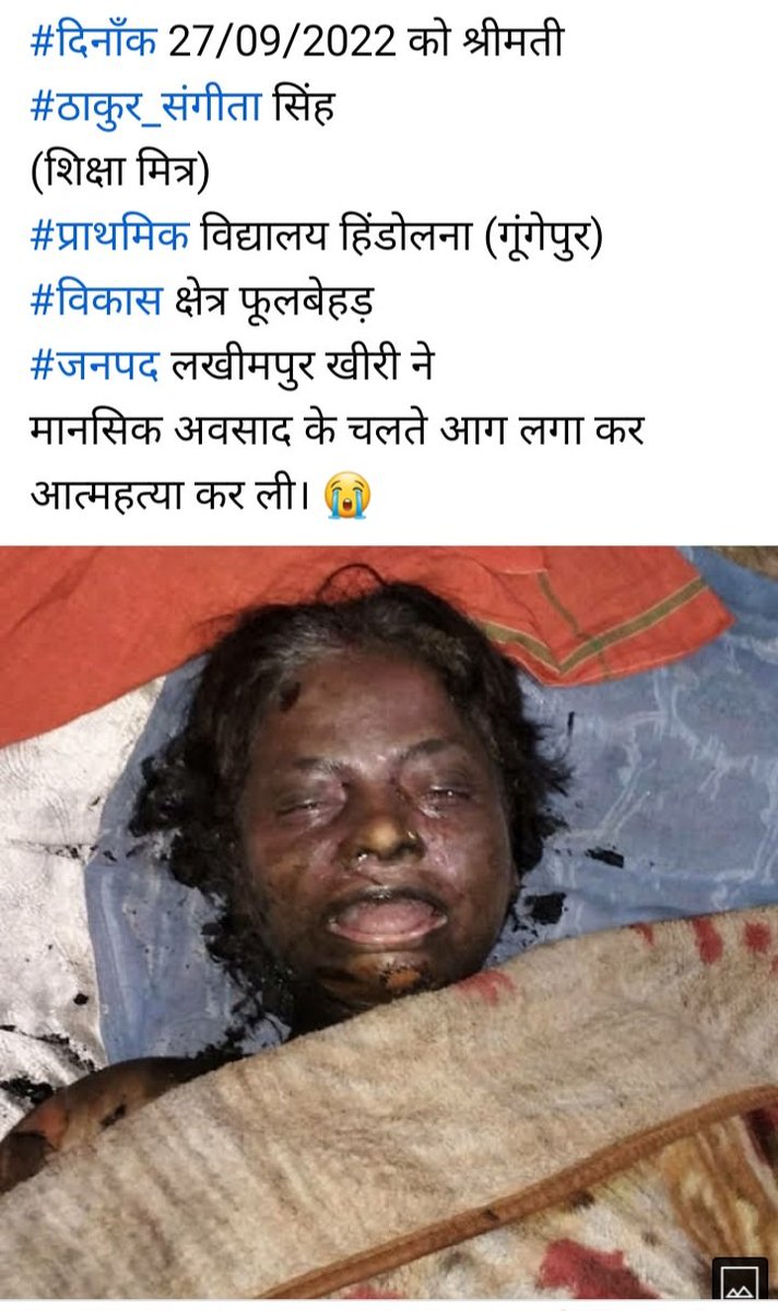 कब तक न्याय मिलेगा ?
   उत्तर प्रदेश के शिक्षा मित्रों को ?
कब पसीजेगा सरकार का दिल हमारे लिए ।
आज फिर एक साथी ने आत्महत्या कर ली मानसिक अवसाद से पीड़ित हो कर ।
  कम से कम सम्मानजनक मानदेय ही कर दे ।
<a href="/CMOfficeUP/">CM Office, GoUP</a> <a href="/thisissanjubjp/">Sandeep Singh</a> <a href="/myogiadityanath/">Yogi Adityanath</a> <a href="/Aamitabh2/">Amitabh Agnihotri</a> <a href="/UPGovt/">Government of UP</a> <a href="/narendramodi/">Narendra Modi</a>