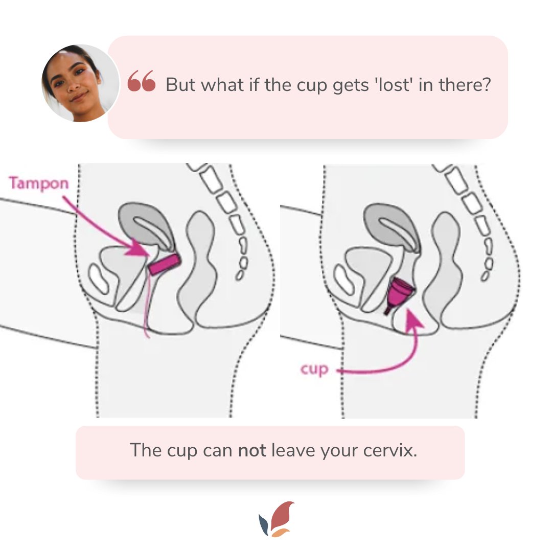 A common fear for those that have never tried a menstrual cup is - the fear of the cup getting ‘lost’.