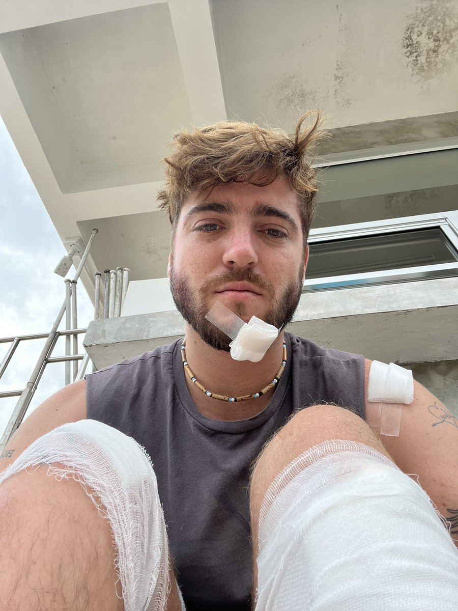 seanvel's tweet photo. Hungover Sean 0 moped 1 🥲 https://t.co/Ss61BZ8f0D