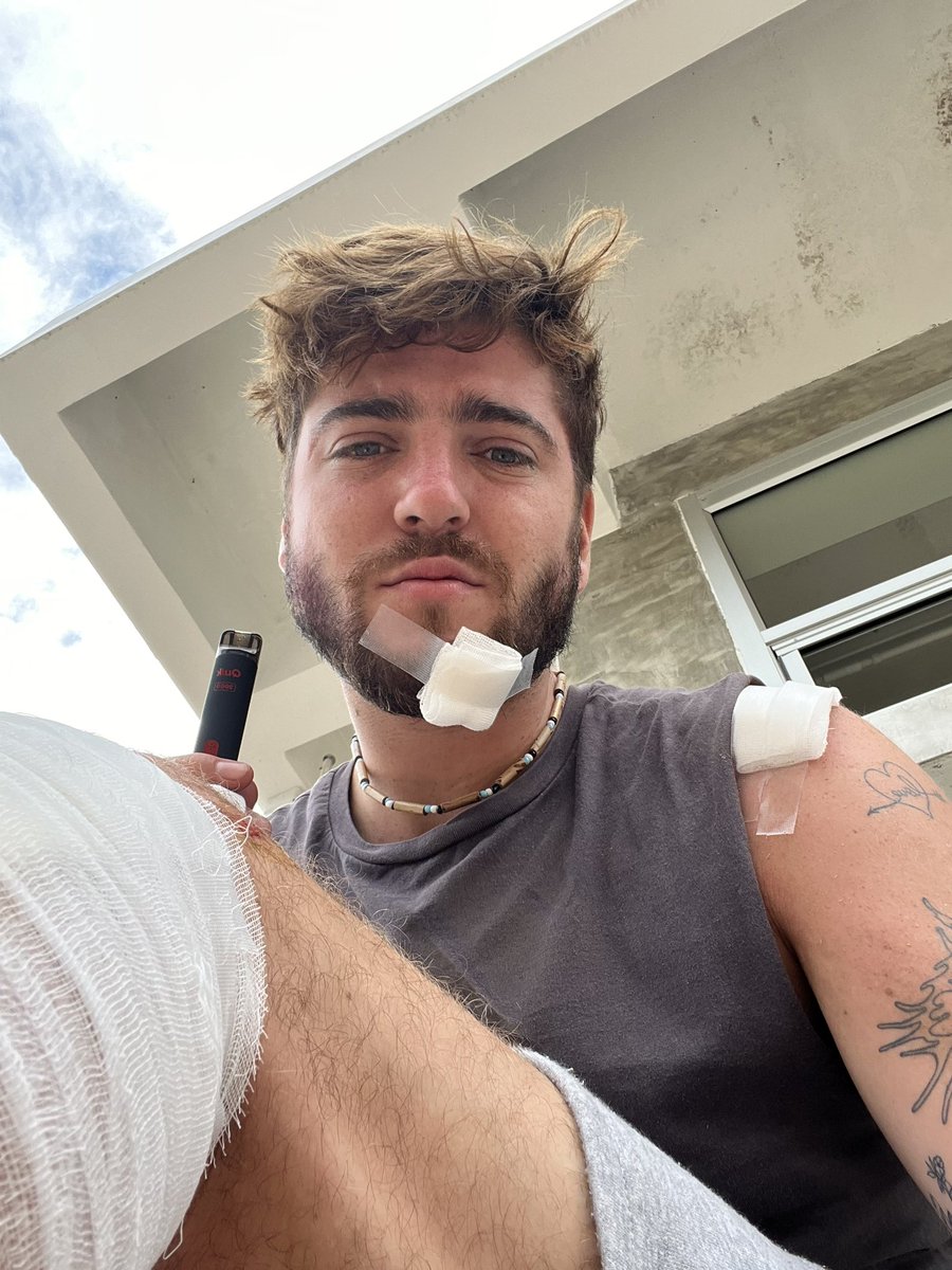 seanvel's tweet photo. Hungover Sean 0 moped 1 🥲 https://t.co/Ss61BZ8f0D