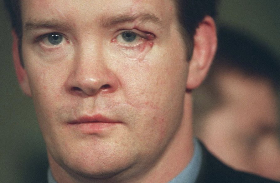 GachetPaul90's tweet photo. En el coche viajaban la Princesa Diana, Dodi Al-Fayed, el guardaespaldas Trevor Rees-Jones y el chofer Henri Paul.

Todos menos su guardaespaldas Trevor  fallecieron en ese accidente. Trevor debido al gran impacto en la cabeza, nunca ha recordado nada del suceso. 

(Justo antes) https://t.co/x1N6b0Uml1