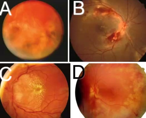 Mayo Clinic Infectious Diseases tweet media