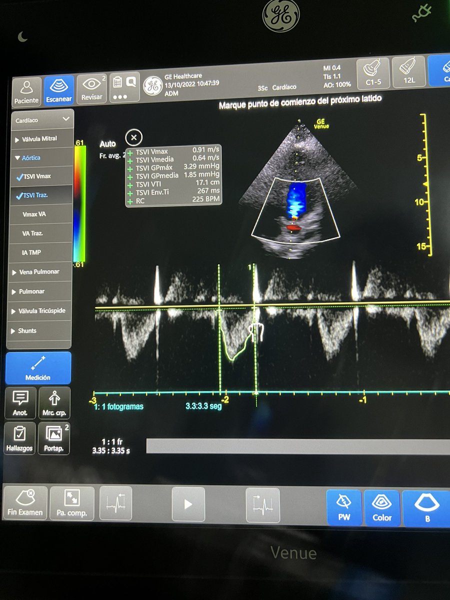 César Corchado tweet media