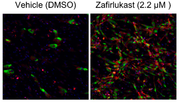 scrippsresearch's tweet photo. Researchers led by @kadzuis & Calibr have uncovered a metabolite that converts white fat (“bad” fat) to brown fat (“good” fat) cells. The finding offers a potential way of addressing metabolic conditions like obesity & type 2 diabetes https://t.co/JLeWZsLPPw @MetabolitesMDPI https://t.co/vpjSBJV5p1