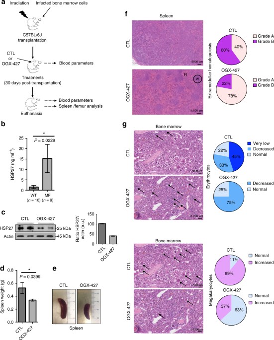 StressMarq's tweet photo. New research suggests #HSP27 is a potential therapeutic target in myelofibrosis: https://t.co/Xt1m8AeM6v https://t.co/0yMyZFfndy