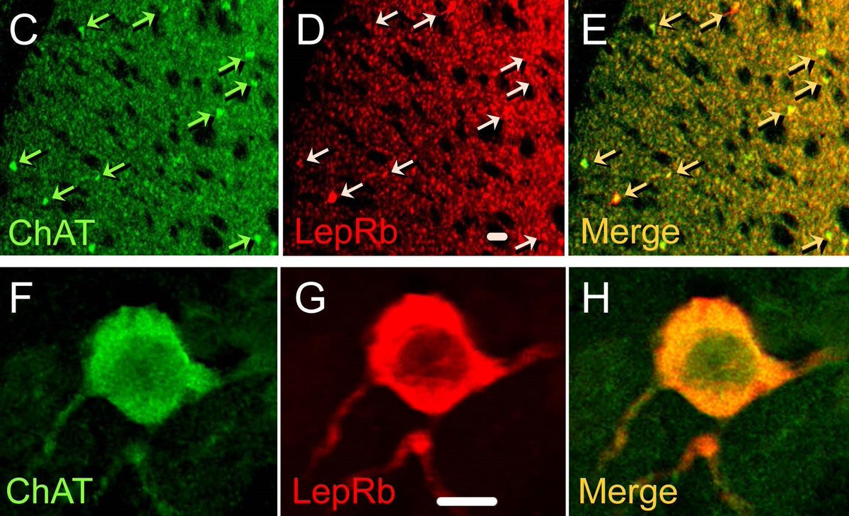 SfNJournals's tweet photo. #JNeurosci: Findings from Mancini et al. @nyugrossman suggests one way that body weight might influence the acutely rewarding impact of food consumption in mice, an effect that is mediated in part by dynamic changes in insulin, leptin, &amp; dopamine.  
https://t.co/wS1wBnKeHi https://t.co/9fBTe19W9H