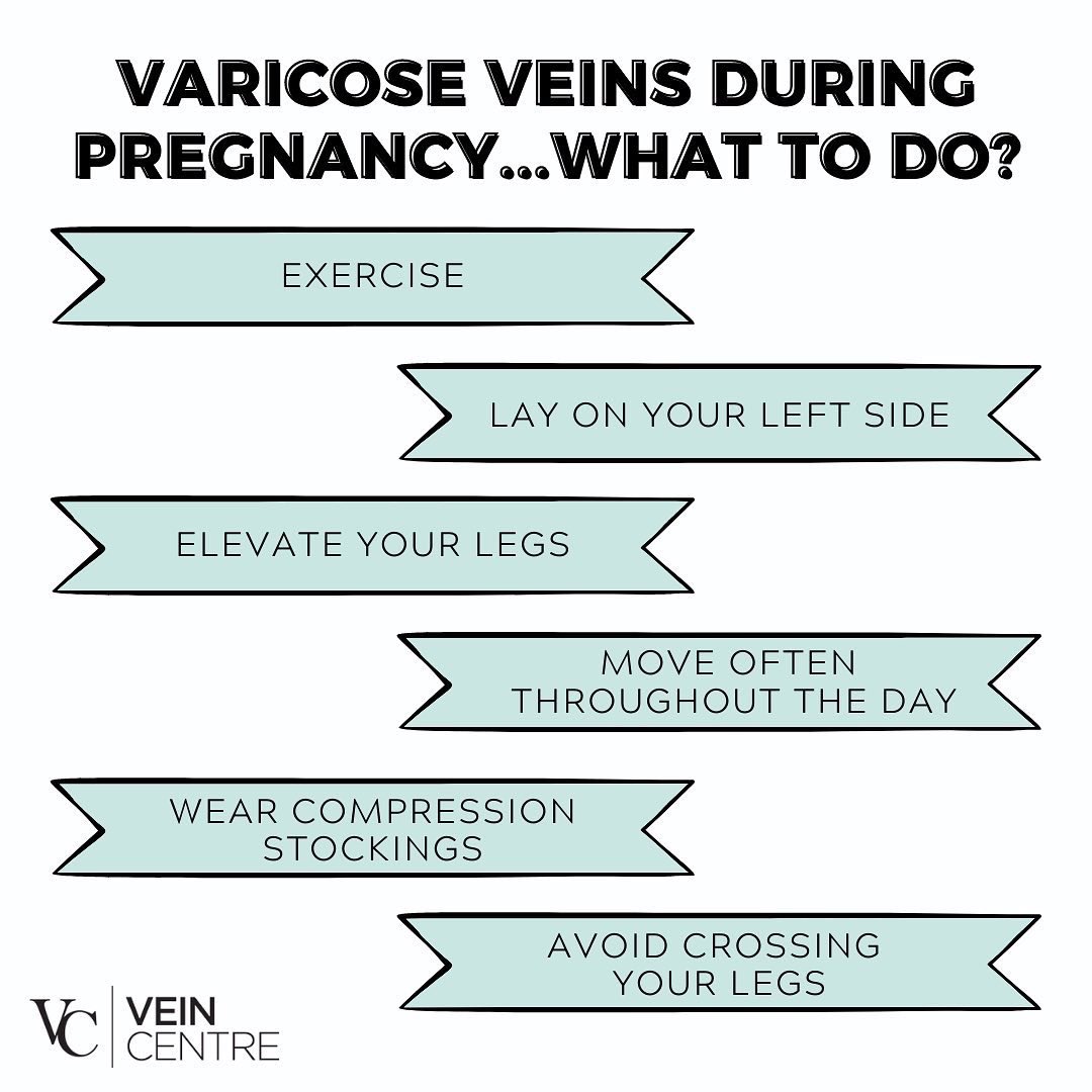 Check out these tips for relieving #varicoseveins during #pregnancy 🤰🏽 ⁣
⁣
⁣#veinhealth #veintreatment #veintreatmentnashville #varicoseveinspregnancy #pregnancynashville  #nashvilleveintreatment #pregnancyveins #nashvillepregnancy #theveincentre #varicoseveinsnashville