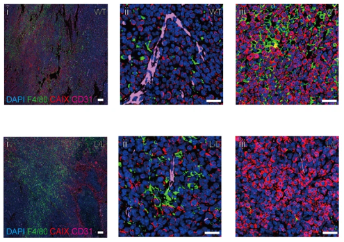 Immune_News's tweet photo. A new study suggests that SET, an #oncoprotein that participates in many cellular processes, modulates tumor immunity by acting as a key regulator of #macrophage positioning and function.

📌 Learn more: https://t.co/oNusgOWuF6 https://t.co/DzqIRVKFTl