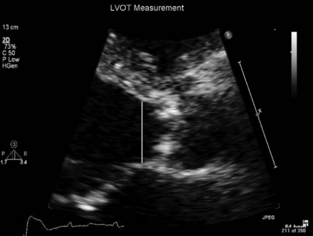 UICcardfellows's tweet photo. Thrilling #EchoConference today with @CD4_Cell and @RoSimmonds leading us on a journey through Apical HCM and Aortic Stenosis facilitated by @Hema_KrishnaMD @tofovic @Ajauseon #LeeFrazin https://t.co/9OQ2VWbXJK