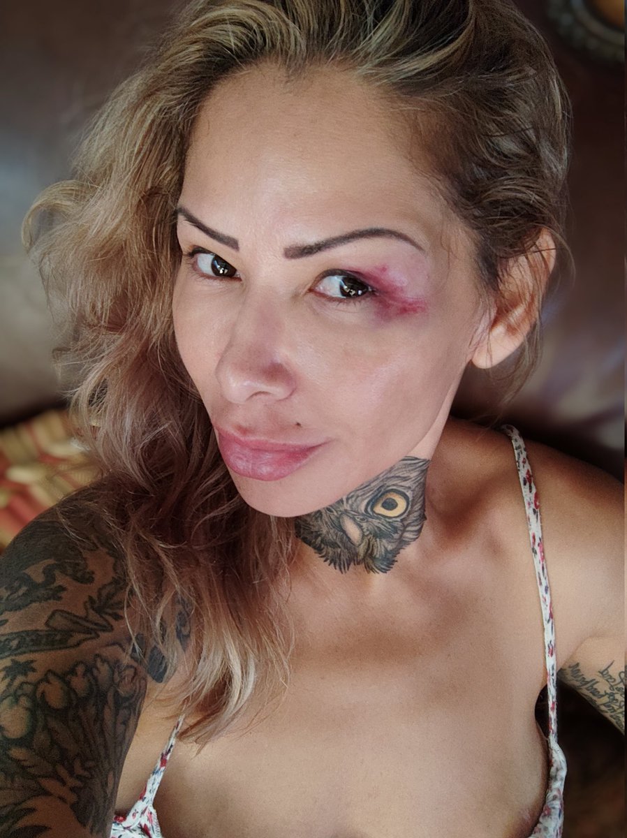 To all of my concerned fans that have written to me reg the black eye on the last 2 uploaded videos to my PH page. Please know that NO ONE abused me. I train Kickboxing and I also train with non lethal weapons. This black eye was completely my fault for NOT wearing my gear.💋❤️