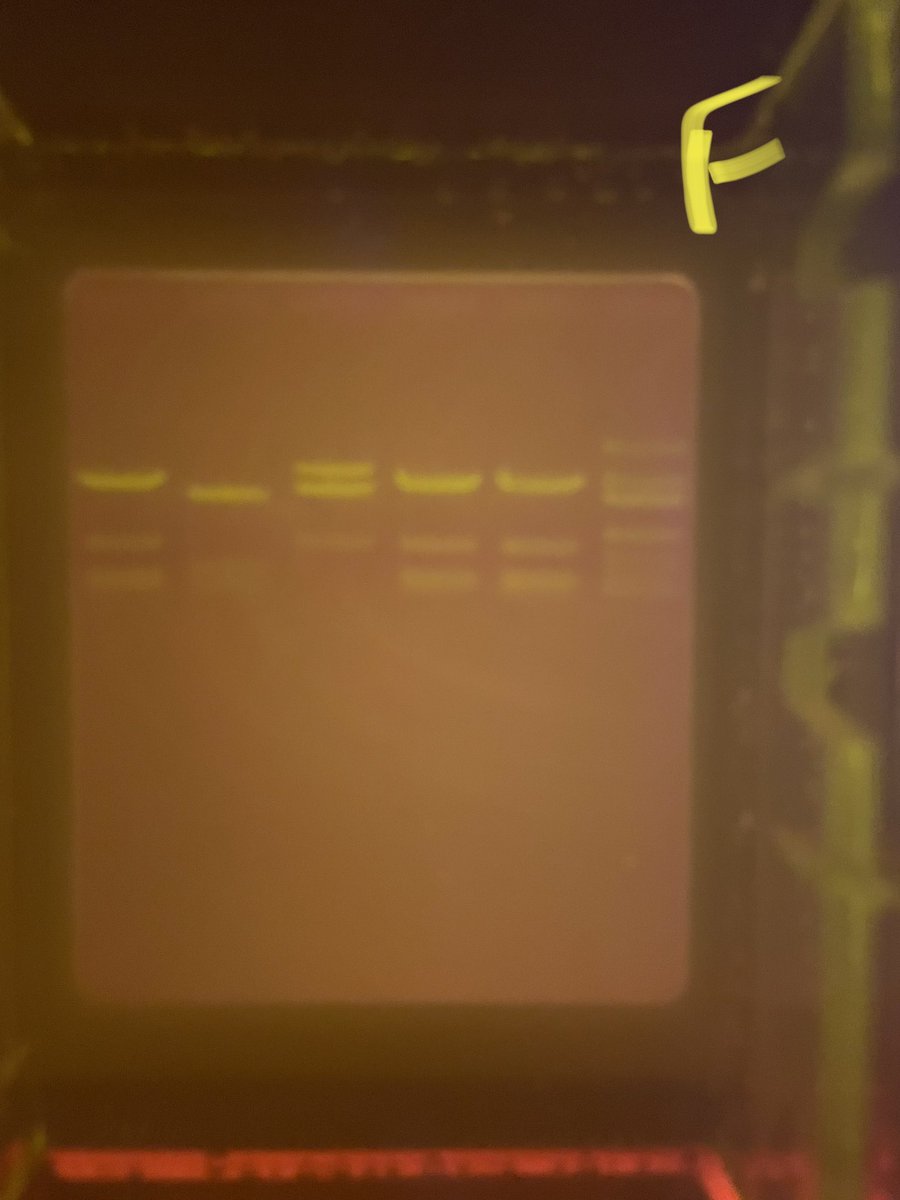 UrichHSScience's tweet photo. DNA analysis/Gel electrophoresis https://t.co/UHwKo8dnQO