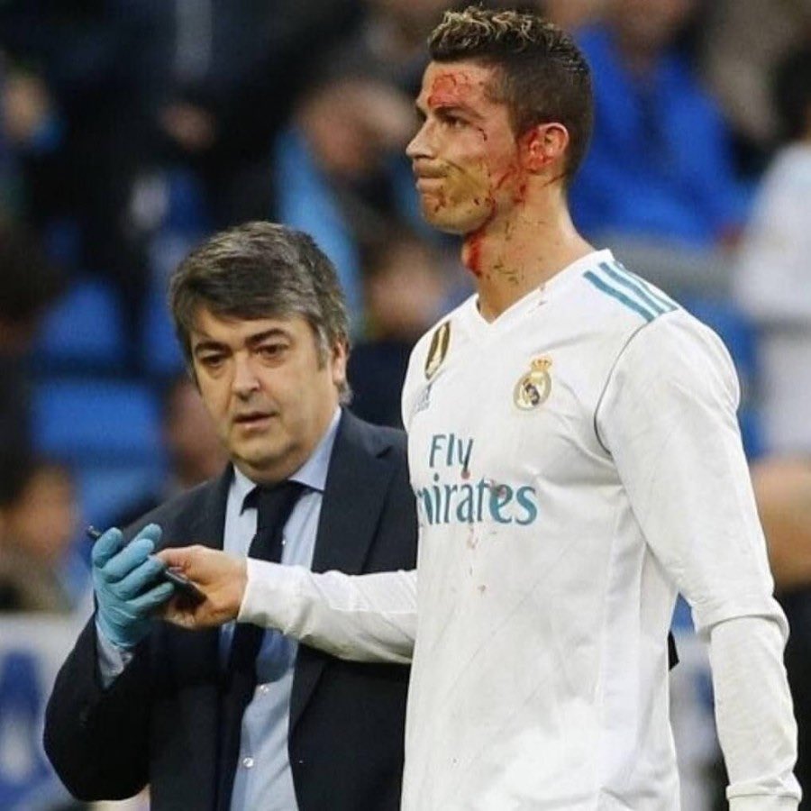 ليس بغريب ..
أندية تتلطخ شعاراتهم بعلم المثليين
ومدريد دائماً يتطلخ شعاره بالدمااء 🤍🤍