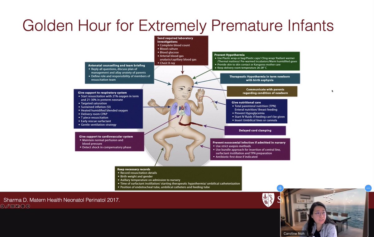 songMD's tweet photo. @nicunoh emphasizing importance of safeguarding #POCUSnicu with established program, education, follow-up assessments
And practical applications that may impact important outcomes!
Impressive @StanfordNeo program spearheaded by @SBhombalK3 & @AlexisDNeoMD
#CANneo
@WomenNeo https://t.co/9QWkigBK7G