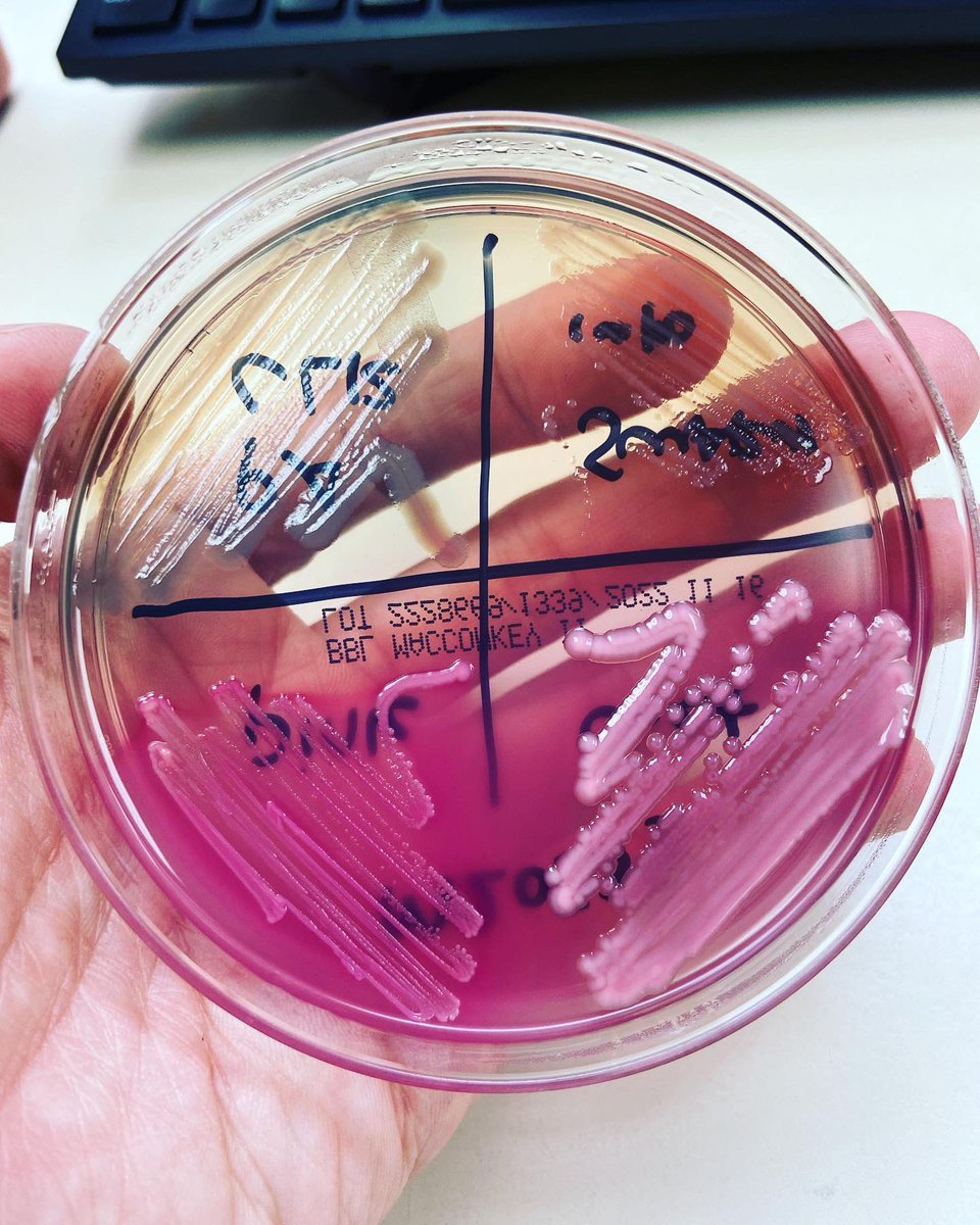 microtech84's tweet photo. And the bugs growing in the culture isolated out. Grp b, pseudomonas, probable ecoli, probable kleb/enterobacter, shewanella, proteus #grpb #pseudomonas #ecoli #kleb #enterobacter #proteus https://t.co/gshoba5Etp