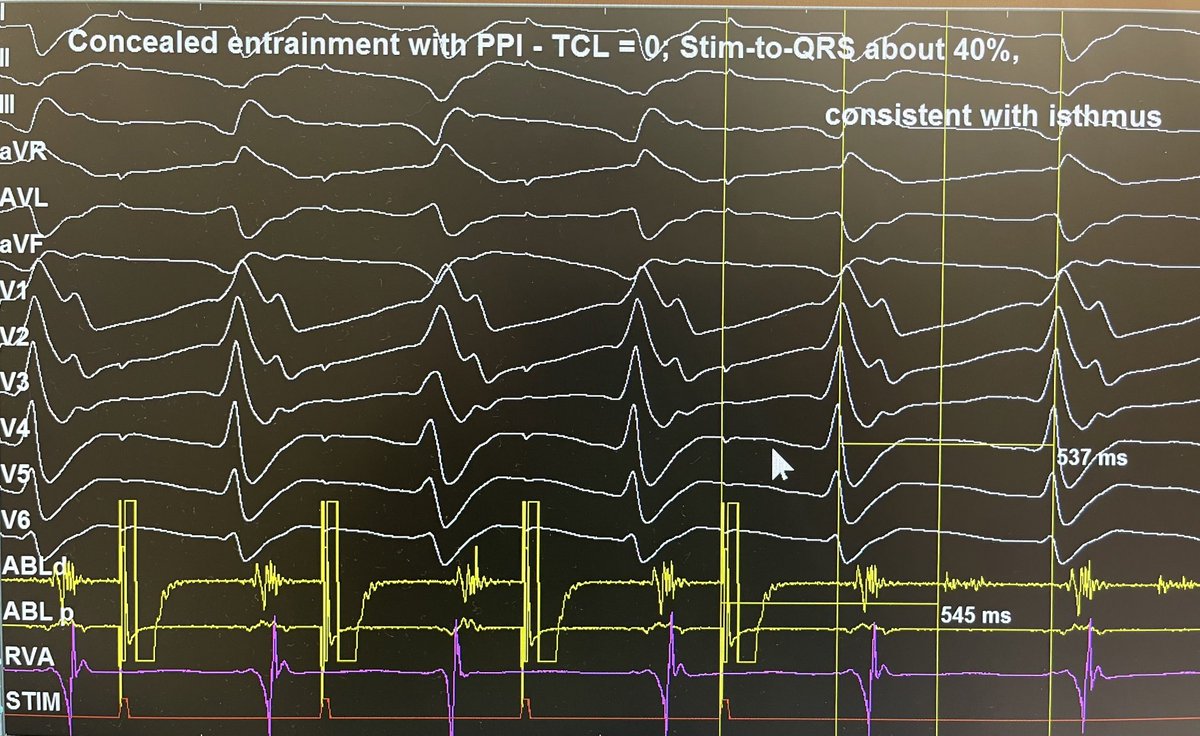 Amit Mehrotra tweet media