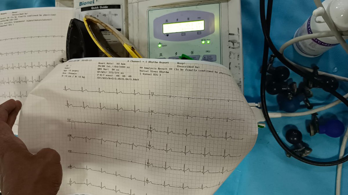 DBSBiomedical's tweet photo. Service#traniee #students #sales#internship #stock #dreamsbiomedicalsolutions #technicalengineers #biomedicalengineer #medixcalelectronics#DBS@dreamsbiomedicalsolutions#medicare#healthcare https://t.co/nSdOnh1i7C